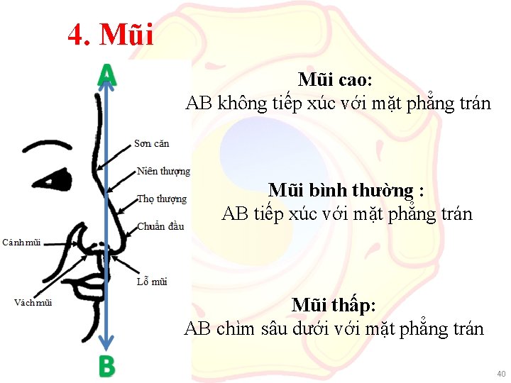 4. Mũi cao: AB không tiếp xúc với mặt phẳng trán Mũi bình thường