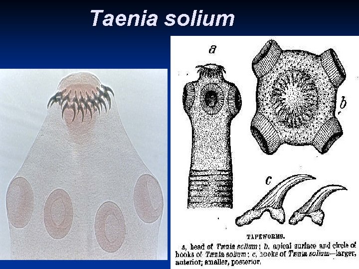 Taenia solium 