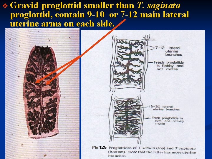 v Gravid proglottid smaller than T. saginata proglottid, contain 9 -10 or 7 -12