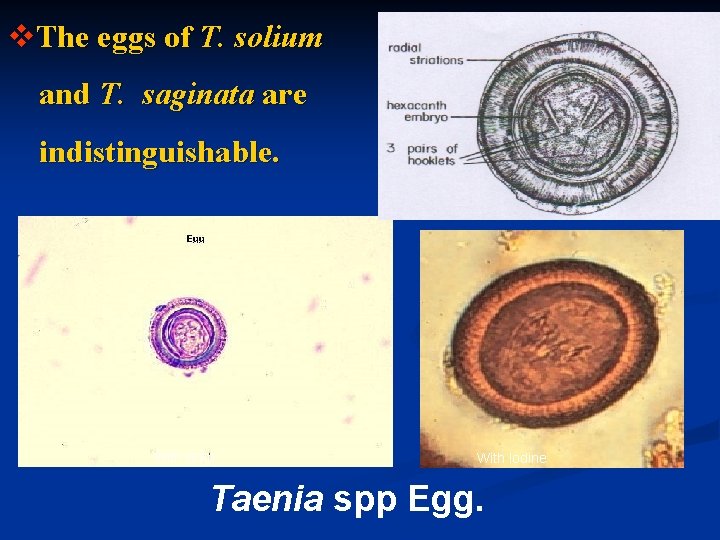 v. The eggs of T. solium and T. saginata are indistinguishable. With stain With