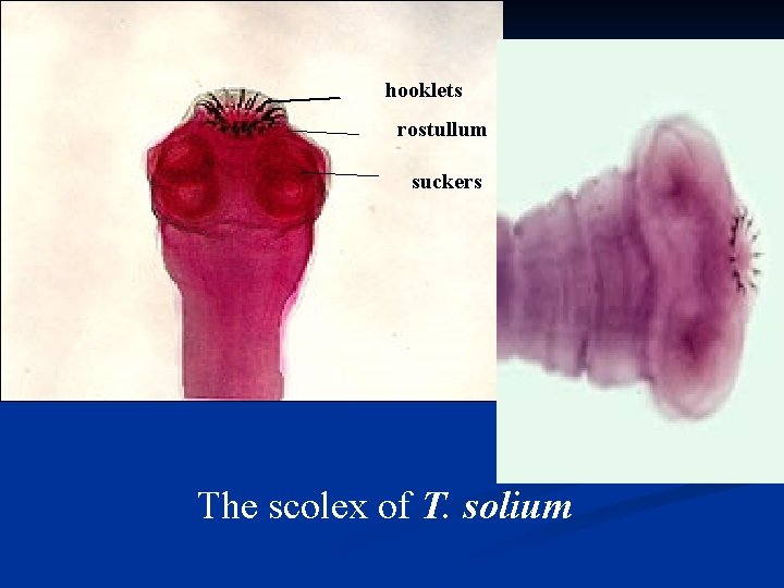 hooklets rostullum suckers The scolex of T. solium 