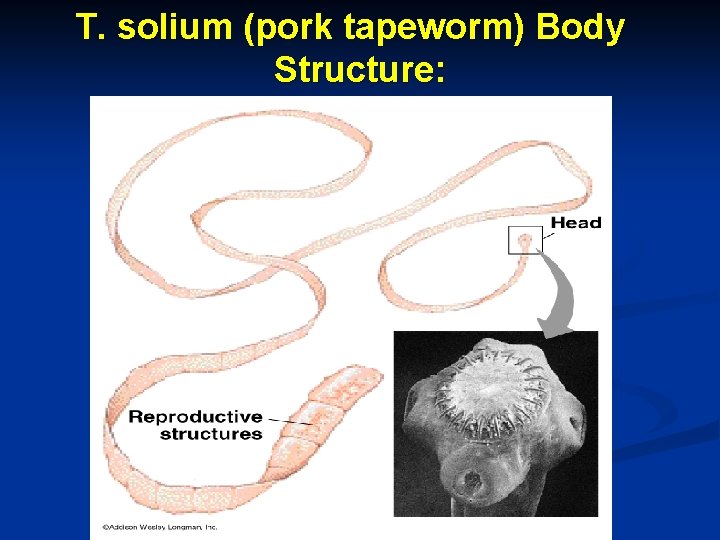 T. solium (pork tapeworm) Body Structure: Scolex and Proglottids 