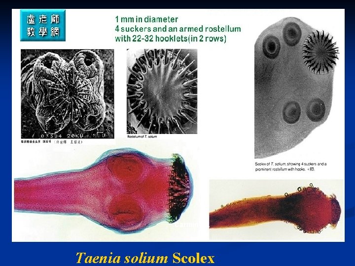 Carmine s. Taenia solium Scolex 