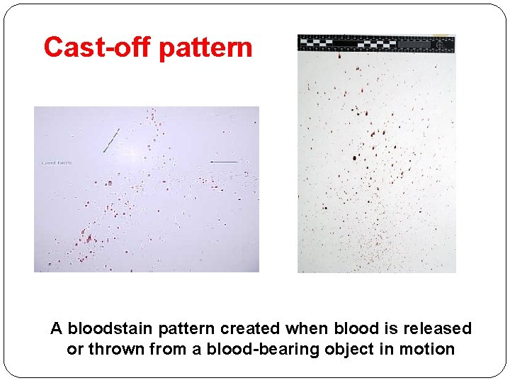 Cast-off pattern A bloodstain pattern created when blood is released or thrown from a