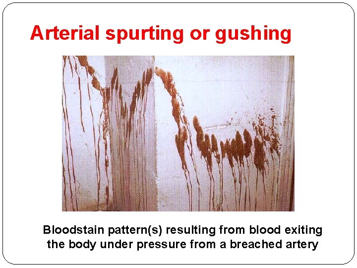 Arterial spurting or gushing Bloodstain pattern(s) resulting from blood exiting the body under pressure