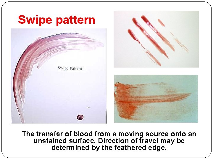 Swipe pattern The transfer of blood from a moving source onto an unstained surface.
