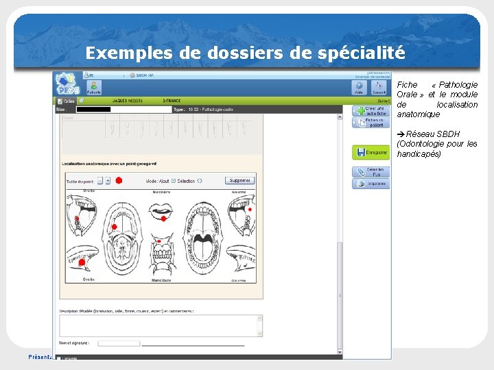 Exemples de dossiers de spécialité Fiche « Pathologie Orale » et le module de