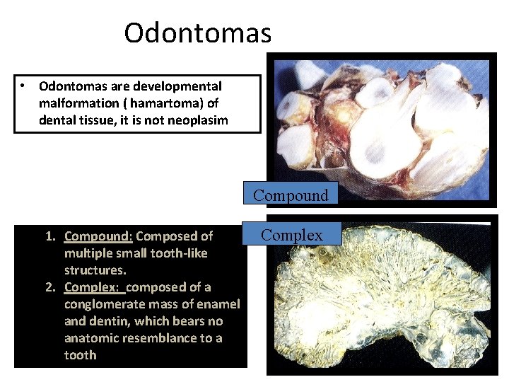 Odontomas • Odontomas are developmental malformation ( hamartoma) of dental tissue, it is not Odontomas • Odontomas are developmental malformation ( hamartoma) of dental tissue, it is not