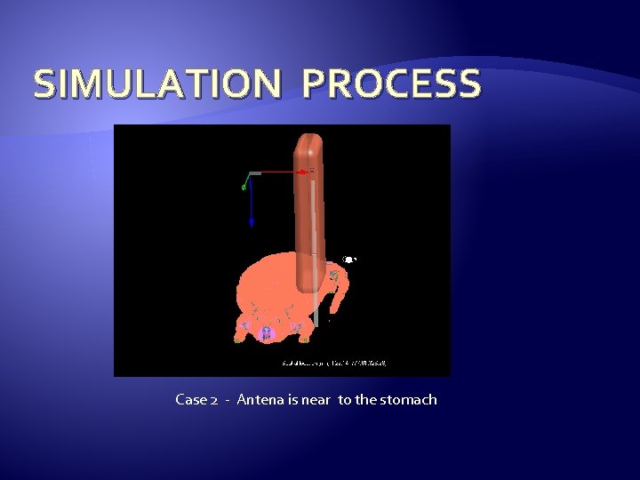 SIMULATION PROCESS Case 2 - Antena is near to the stomach 