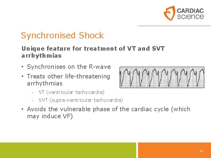 Synchronised Shock Unique feature for treatment of VT and SVT arrhythmias • Synchronises on