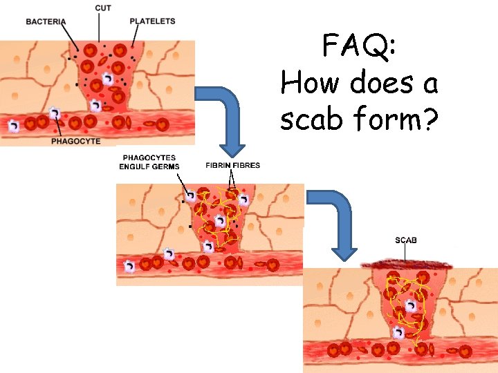 FAQ: How does a scab form? 