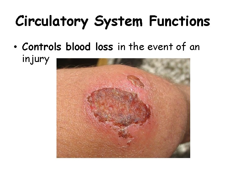 Circulatory System Functions • Controls blood loss in the event of an injury 