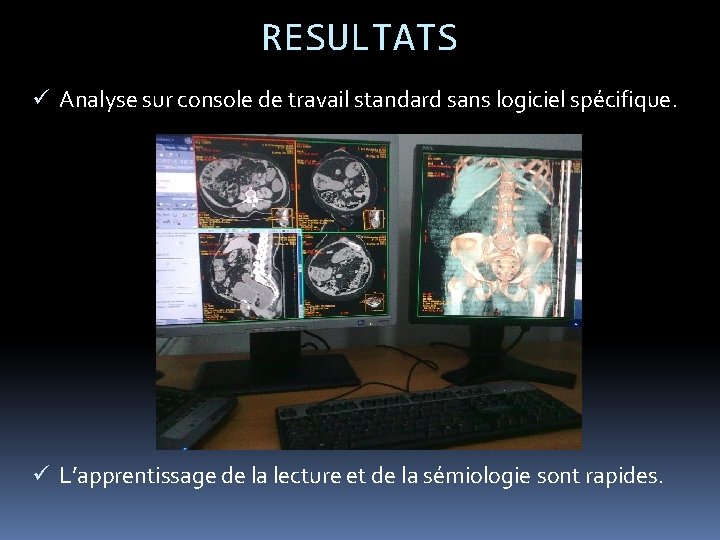 RESULTATS ü Analyse sur console de travail standard sans logiciel spécifique. ü L’apprentissage de