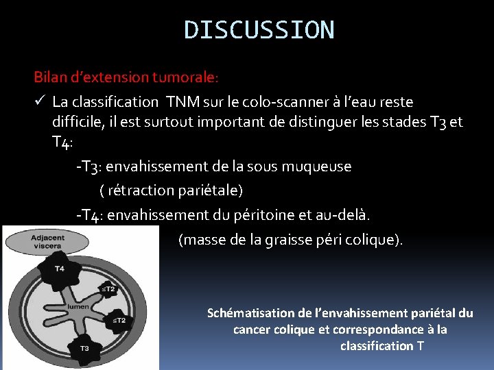 DISCUSSION Bilan d’extension tumorale: ü La classification TNM sur le colo-scanner à l’eau reste