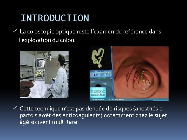 INTRODUCTION ü La coloscopie optique reste l’examen de référence dans l’exploration du colon. ü