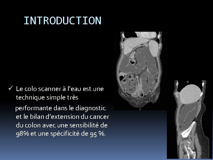 INTRODUCTION ü Le colo scanner à l’eau est une technique simple très performante dans