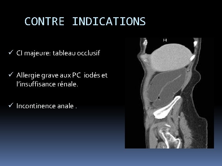 CONTRE INDICATIONS ü CI majeure: tableau occlusif ü Allergie grave aux PC iodés et