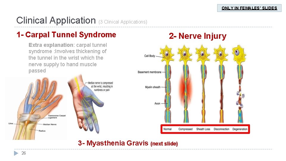 ONLY IN FEMALES’ SLIDES Clinical Application (3 Clinical Applications) 1 - Carpal Tunnel Syndrome ONLY IN FEMALES’ SLIDES Clinical Application (3 Clinical Applications) 1 - Carpal Tunnel Syndrome