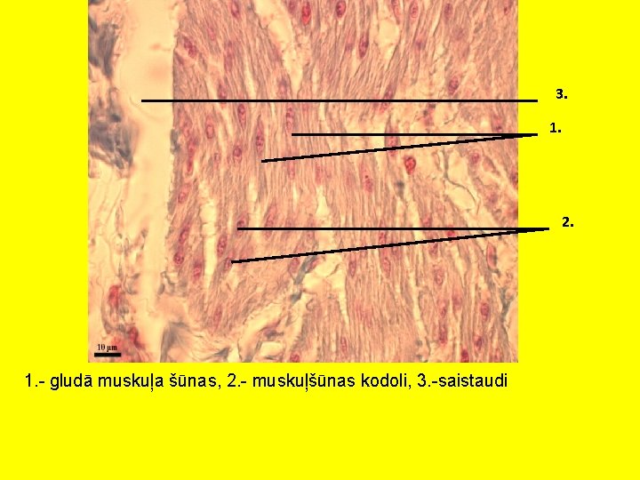 3. 1. 2. 1. - gludā muskuļa šūnas, 2. - muskuļšūnas kodoli, 3. -saistaudi