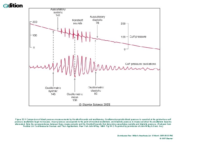 Figure 32 -3 Comparison of blood pressure measurements by Korotkoff sounds and oscillometry. Oscillometric