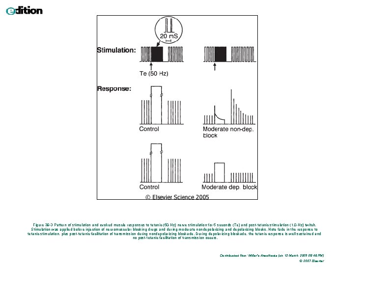 Figure 39 -3 Pattern of stimulation and evoked muscle responses to tetanic (50 -Hz)