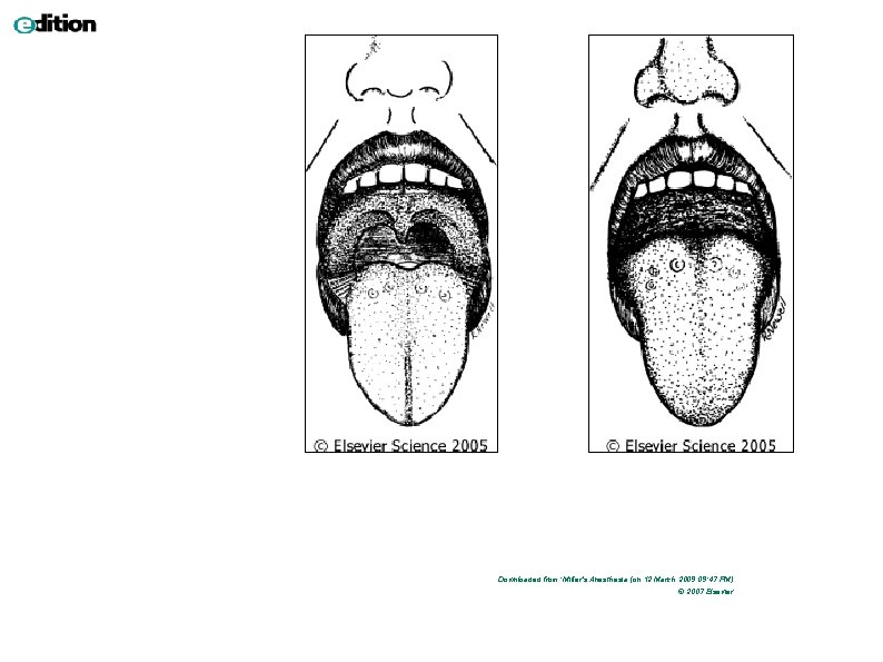 Downloaded from: Miller's Anesthesia (on 12 March 2009 09: 47 PM) © 2007 Elsevier