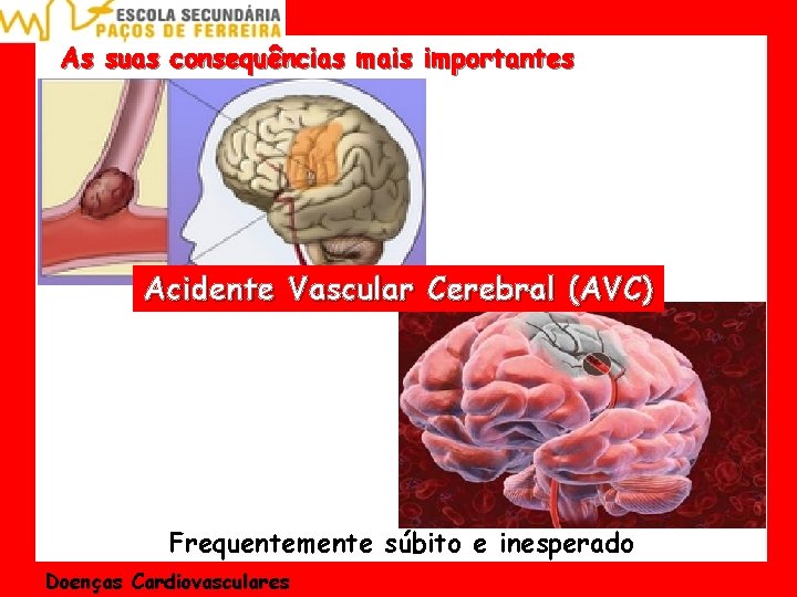 As suas consequências mais importantes Acidente Vascular Cerebral (AVC) Frequentemente súbito e inesperado Doenças