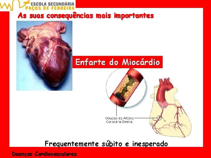 As suas consequências mais importantes Enfarte do Miocárdio Frequentemente súbito e inesperado Doenças Cardiovasculares