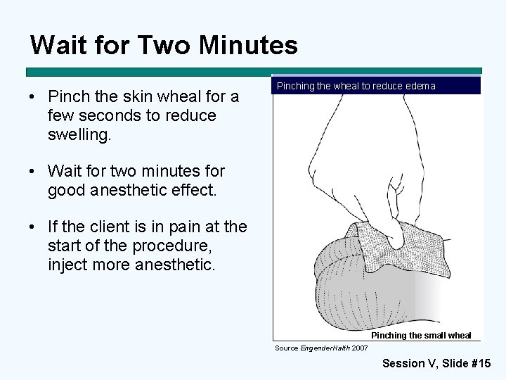 Wait for Two Minutes • Pinch the skin wheal for a few seconds to