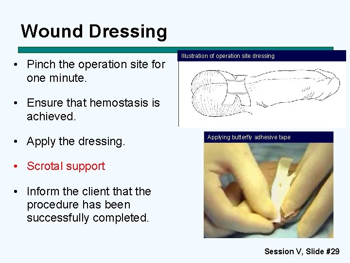 Wound Dressing • Pinch the operation site for one minute. Illustration of operation site