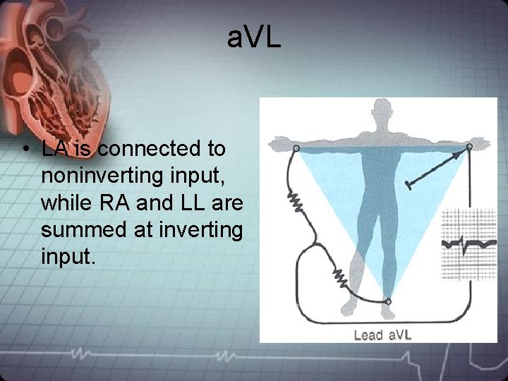 a. VL • LA is connected to noninverting input, while RA and LL are a. VL • LA is connected to noninverting input, while RA and LL are