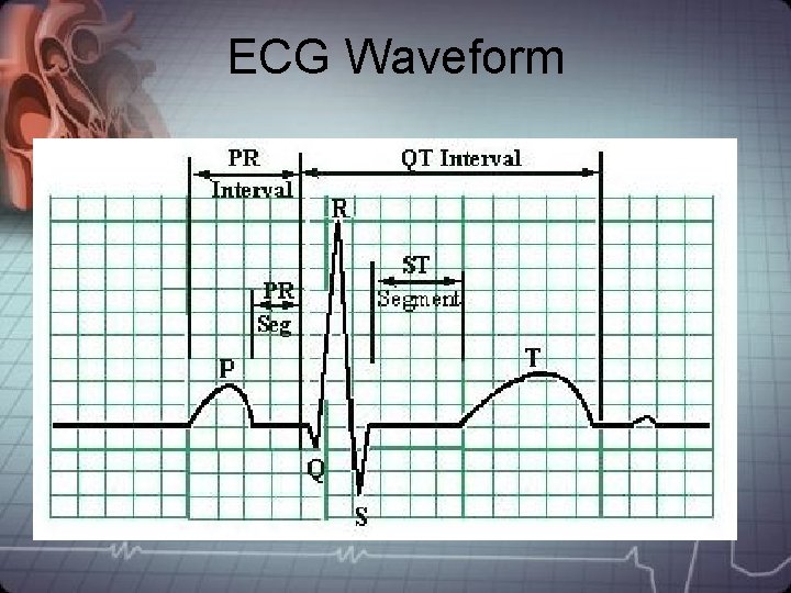 ECG Waveform ECG Waveform