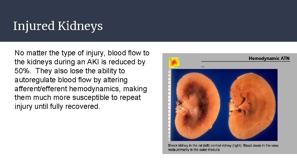 Injured Kidneys No matter the type of injury, blood flow to the kidneys during