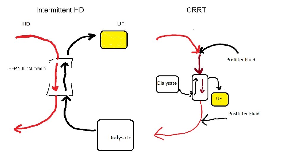 Intermittent HD BFR 200 -450 ml/min CRRT 