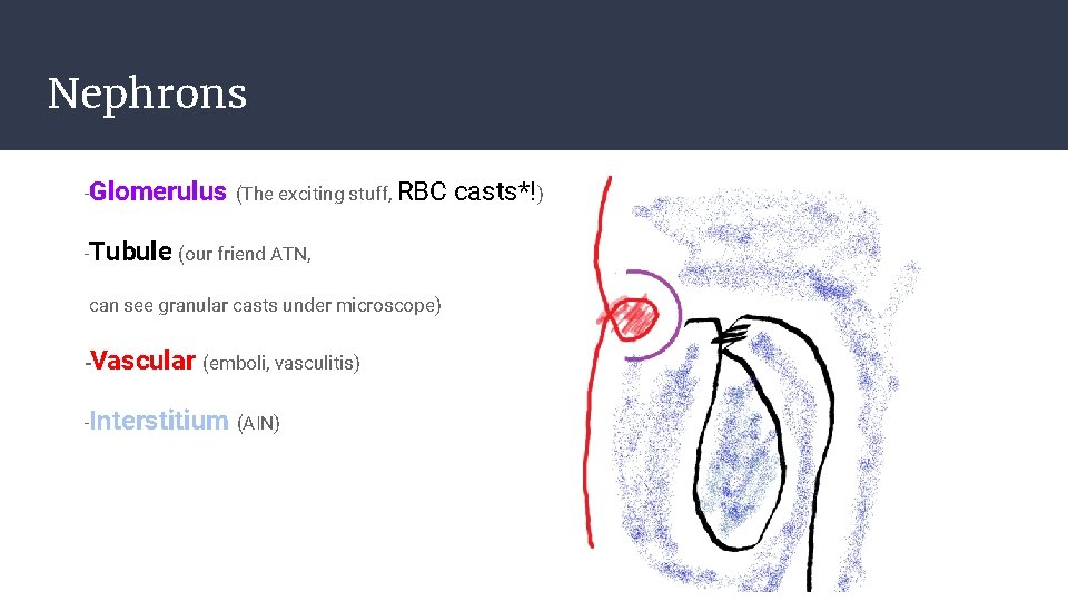 Nephrons -Glomerulus (The exciting stuff, RBC -Tubule (our friend ATN, can see granular casts