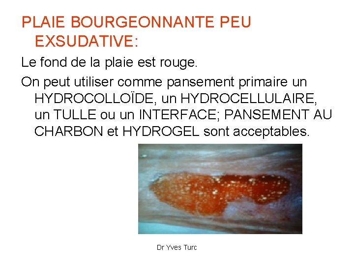 PLAIE BOURGEONNANTE PEU EXSUDATIVE: Le fond de la plaie est rouge. On peut utiliser