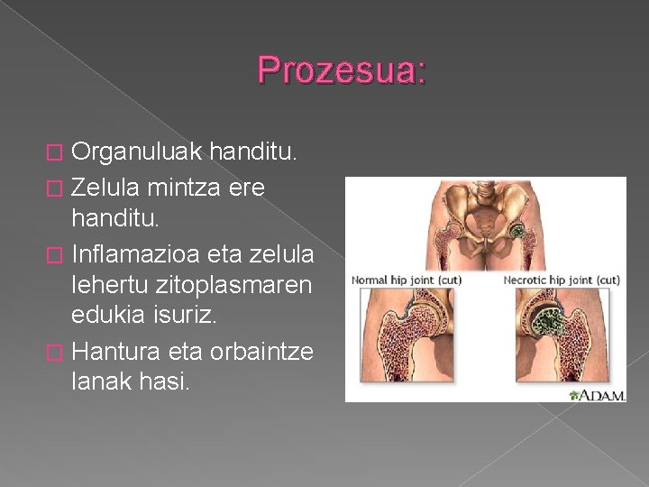 Prozesua: Organuluak handitu. � Zelula mintza ere handitu. � Inflamazioa eta zelula lehertu zitoplasmaren