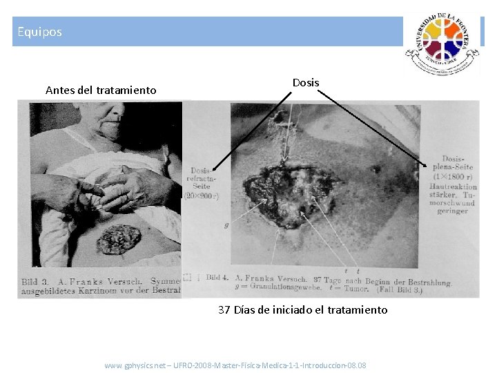 Equipos Antes del tratamiento Dosis 37 Días de iniciado el tratamiento www. gphysics. net