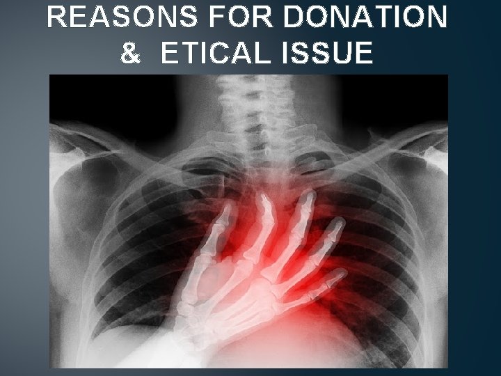REASONS FOR DONATION & ETICAL ISSUE 