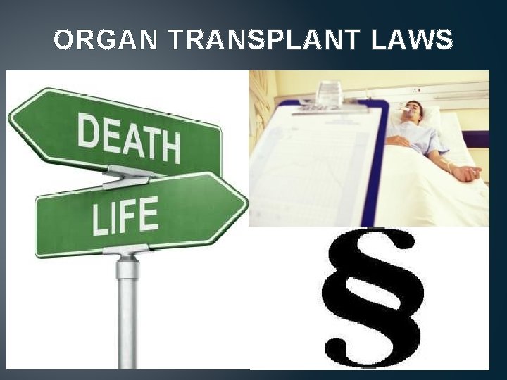 ORGAN TRANSPLANT LAWS 