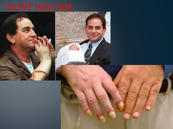 CLINT HALLAM 