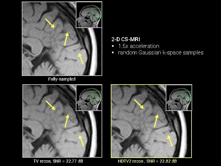 2 -D CS-MRI § 1. 5 x acceleration § random Gaussian k-space samples Fully-sampled