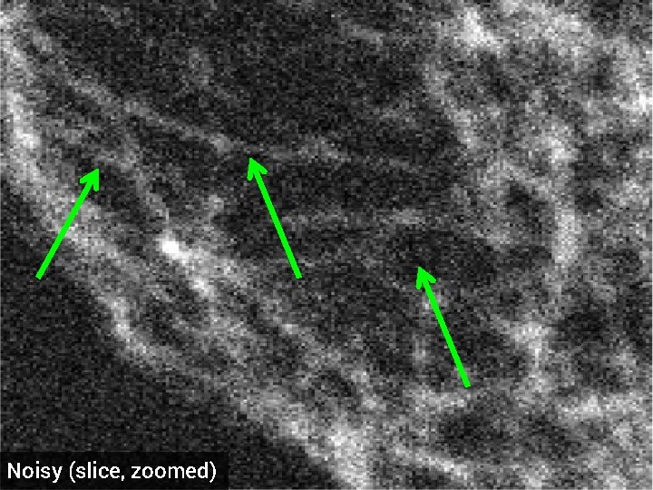 Noisy (slice, zoomed) 