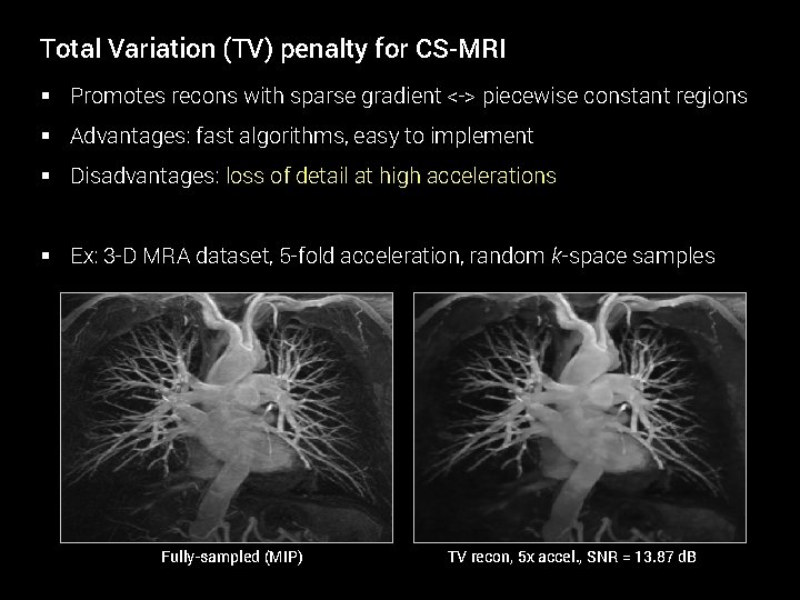 Total Variation (TV) penalty for CS-MRI § Promotes recons with sparse gradient <-> piecewise