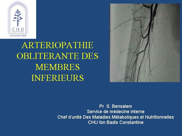 ARTERIOPATHIE OBLITERANTE DES MEMBRES INFERIEURS Pr S. Bensalem Service de médecine interne Chef d’unité