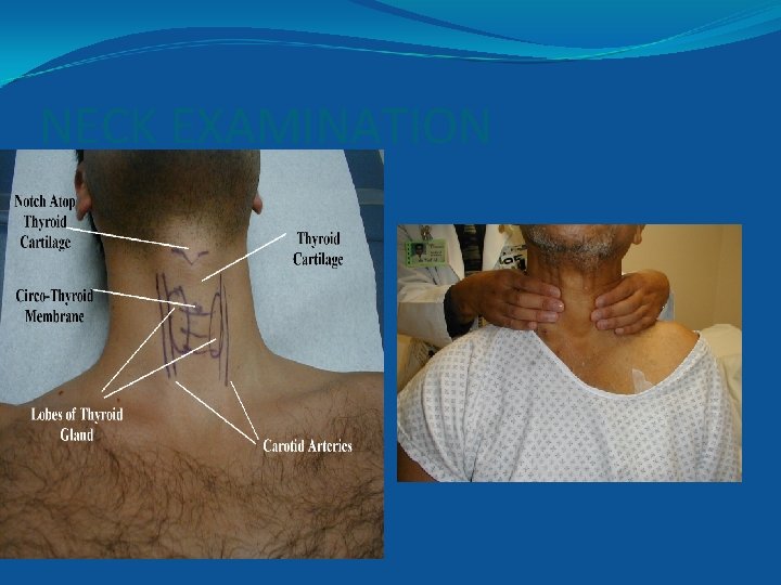 Compression Neck Exam PHYSICAL SIGNS OF THE NECK Triangles of the