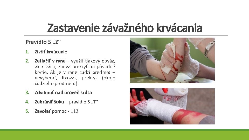 Zastavenie závažného krvácania Pravidlo 5 „Z“ 1. Zistiť krvácanie 2. Zatlačiť v rane –