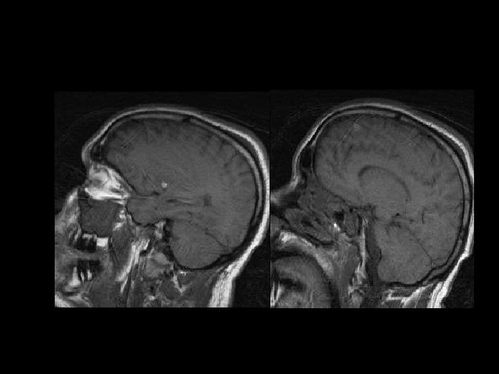 Sagittal T 1 -W images 