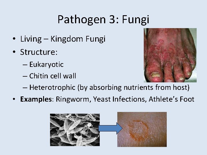 Pathogen 3: Fungi • Living – Kingdom Fungi • Structure: – Eukaryotic – Chitin