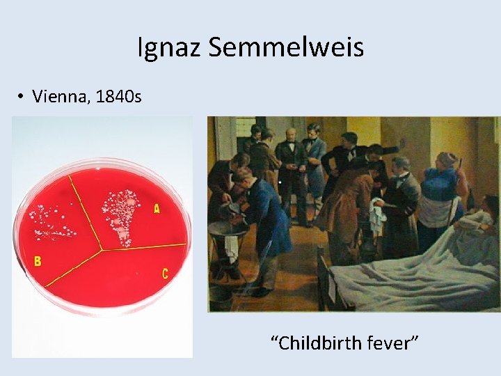 Ignaz Semmelweis • Vienna, 1840 s “Childbirth fever” 